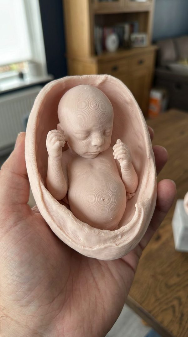 Baby Sculpture From Ultrasound